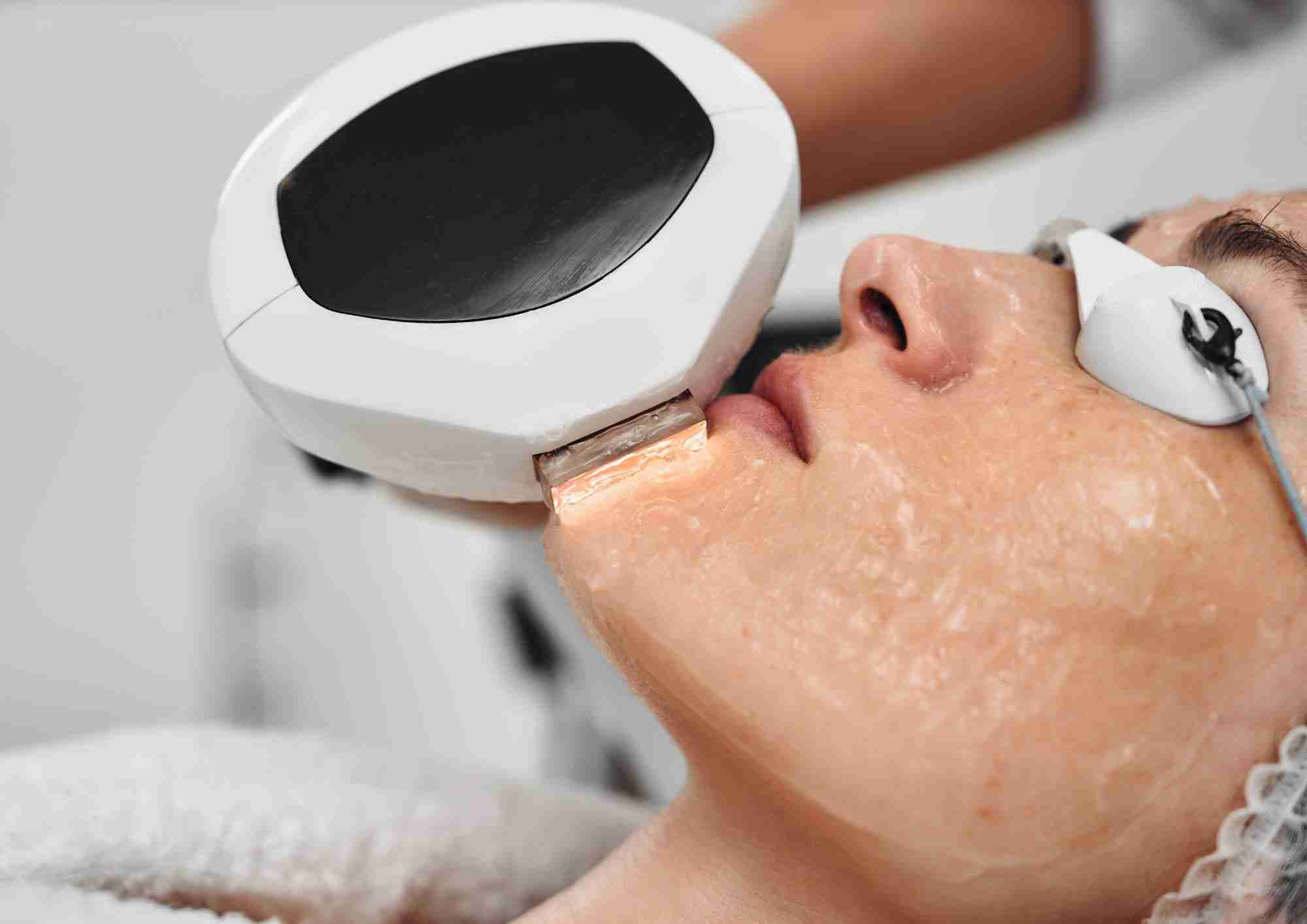 Is IPL Hair Removal Worth It? Pros & Cons Explained