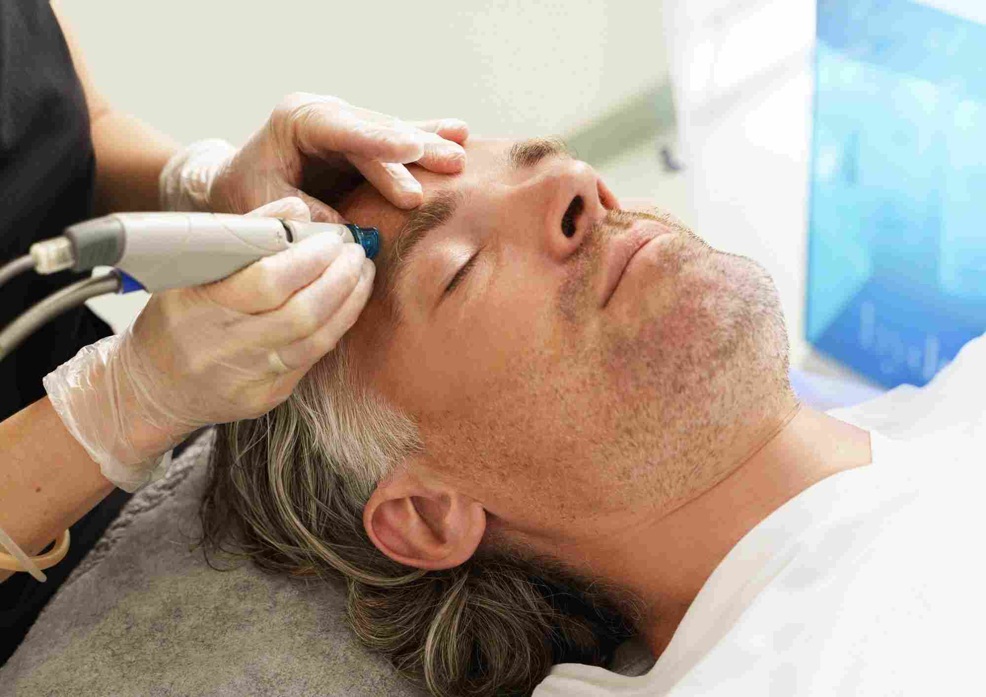 How Pico Laser Treatment Helps with Skin Rejuvenation