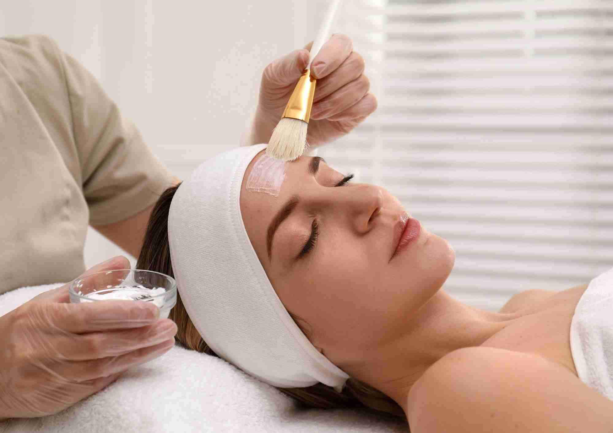 The Best Aftercare Tips for Chemical Peel Treatment