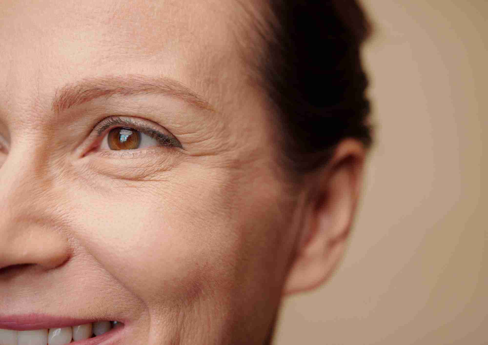 Why Pico Laser Is the Best Option for Reducing Wrinkles
