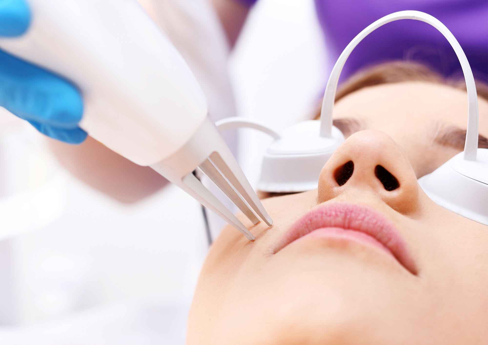 Discover the Best Deals for Laser Hair Removal | Smooth Kitty