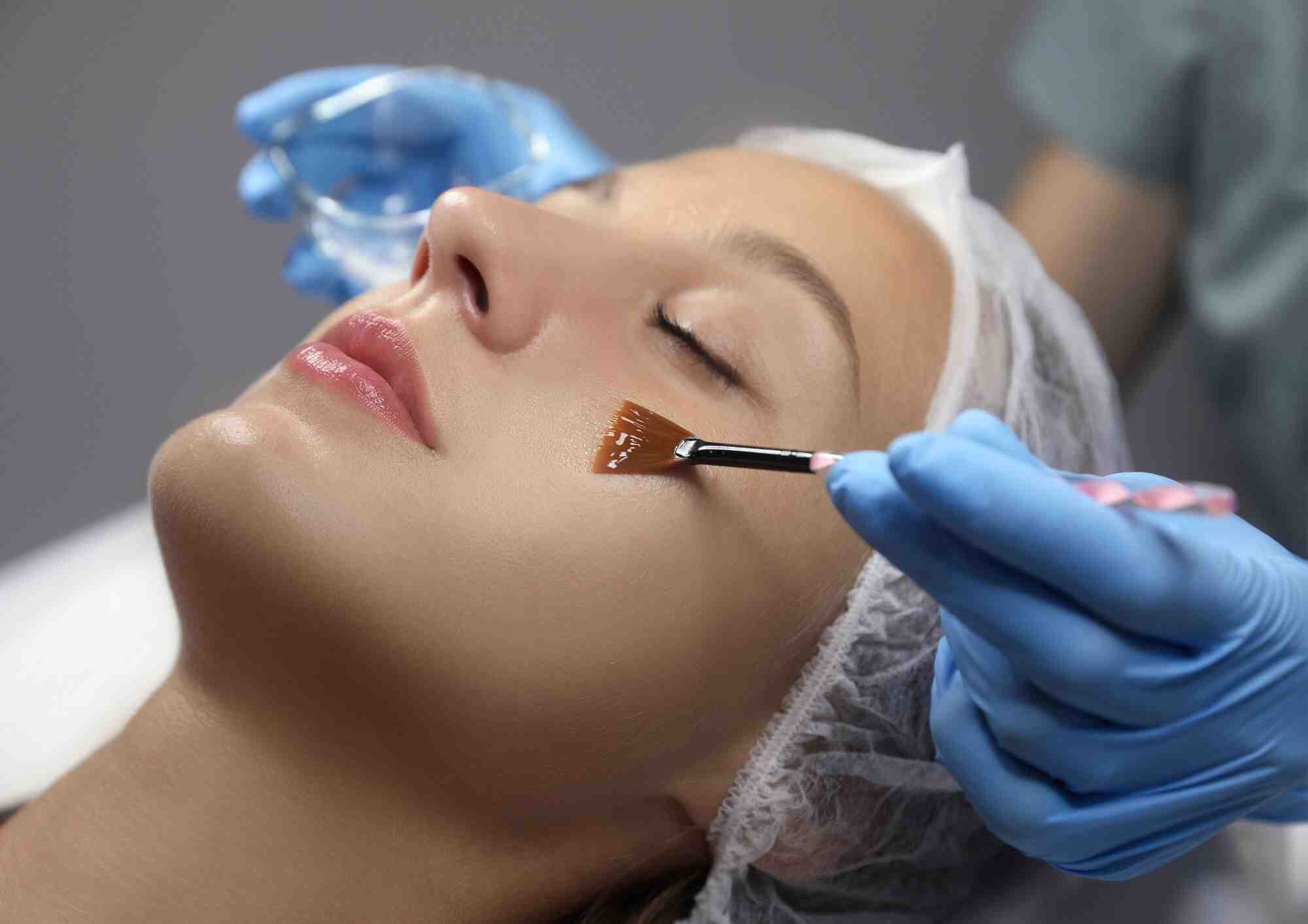 Is Chemical Peel Treatment Right for Your Skin Type?