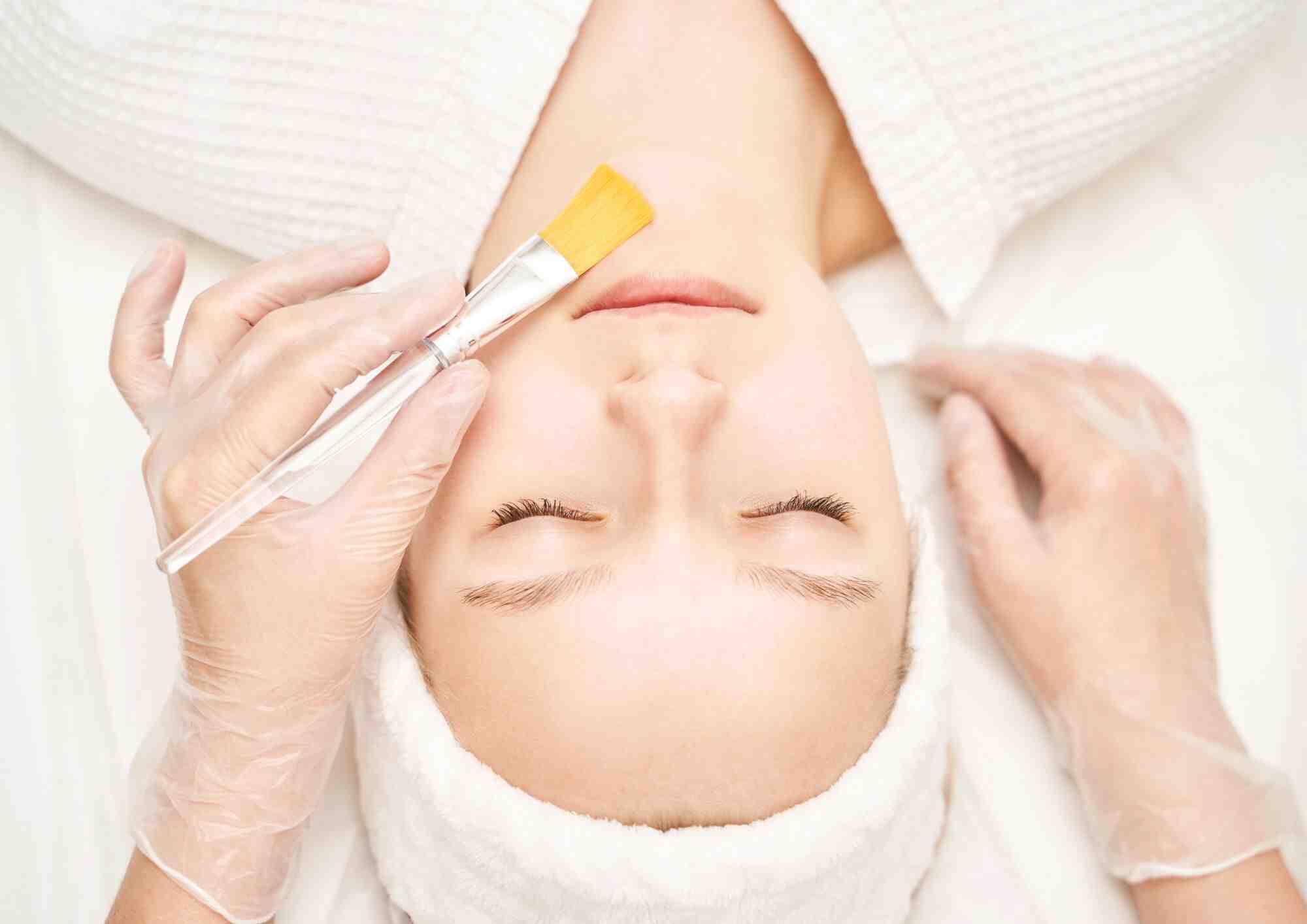 What Is Chemical Peel Treatment | How Does It Work?