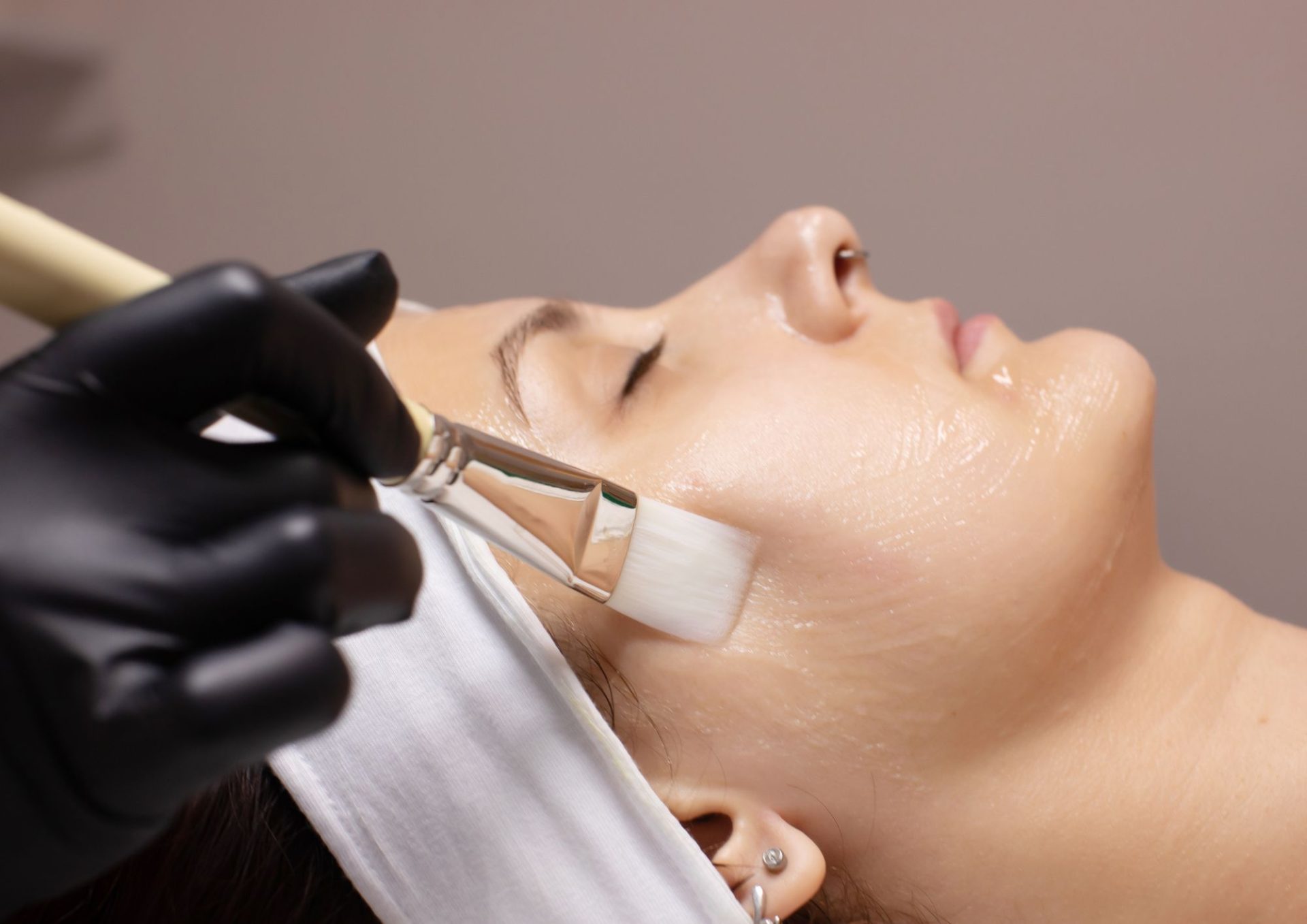 Chemical Peel Treatment: Benefits for Glowing Skin