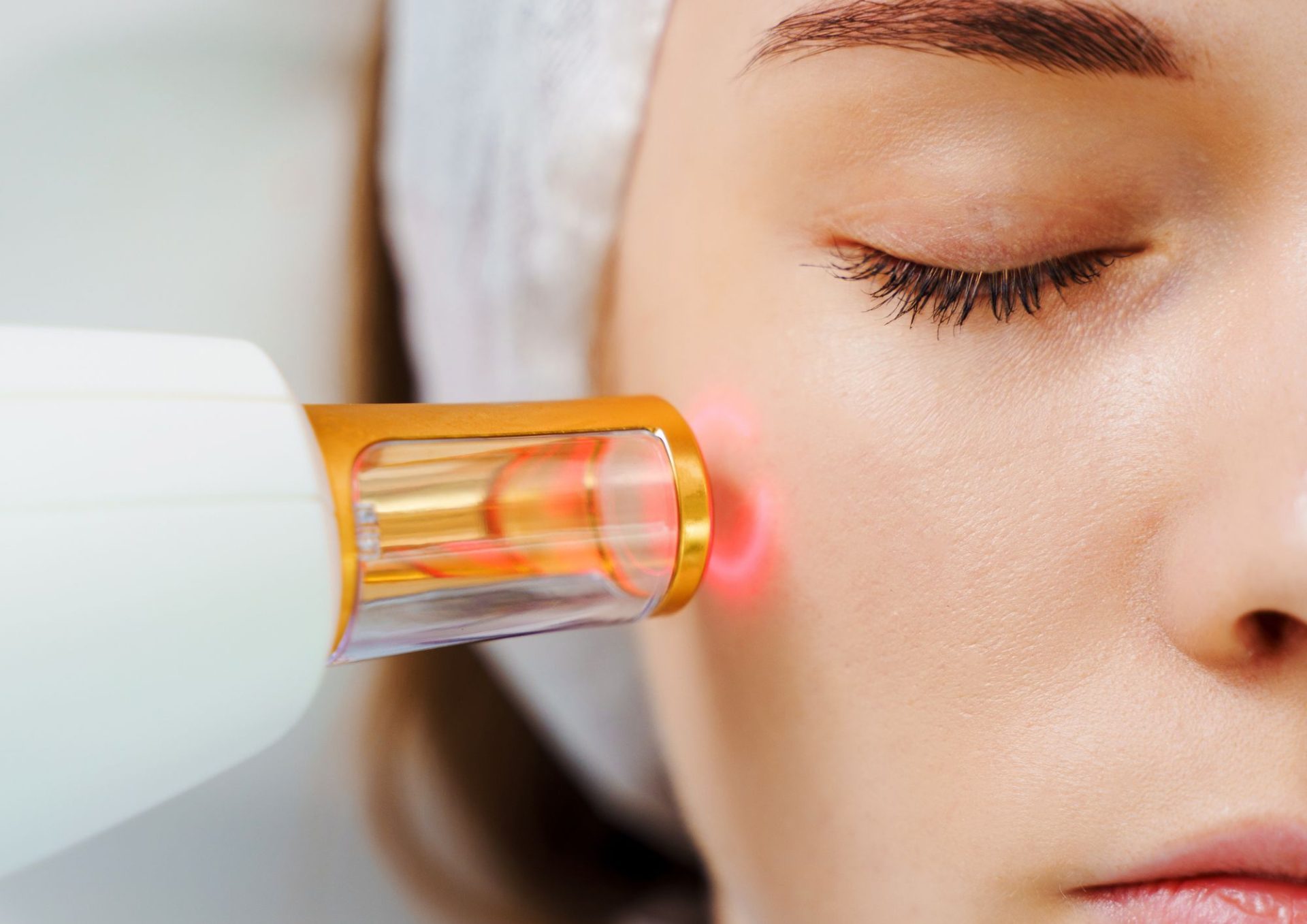 Pico Laser Near Me | Skin Brightening at Smooth Kitty