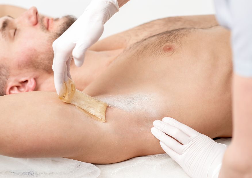 Laser Hair Removal: The Better Alternative to Boyzilian Wax for Men