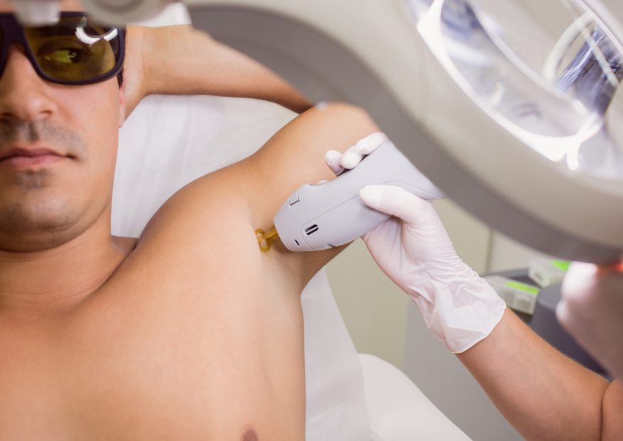 Boyzilian Wax for Hygiene and Odor: Is Laser Better?