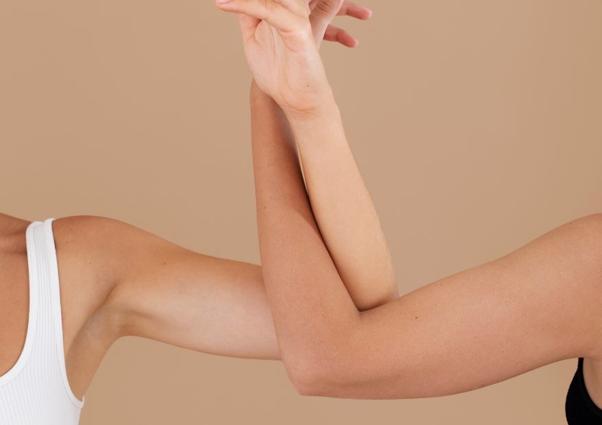 How IPL Hair Removal Affects Different Skin Tones