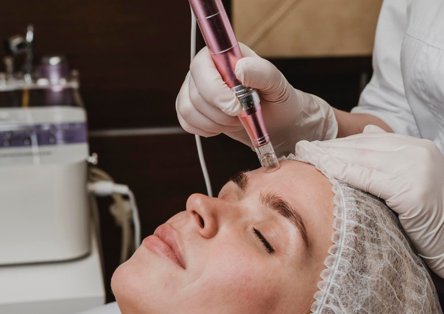 Pico Laser Treatment for Large Pores: Can It Minimize Them?