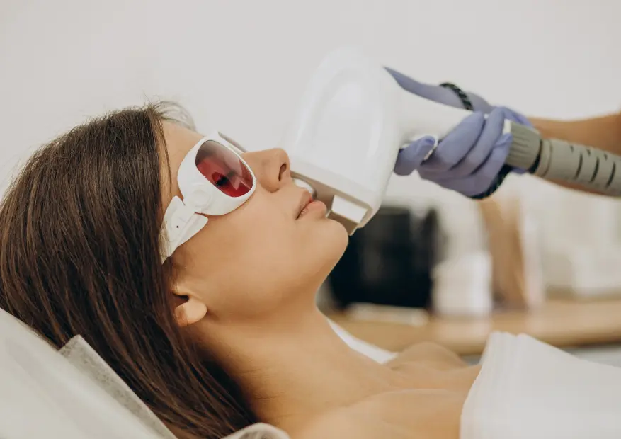 Is IPL Hair Removal Suitable for Facial Hair? | Smooth Kitty