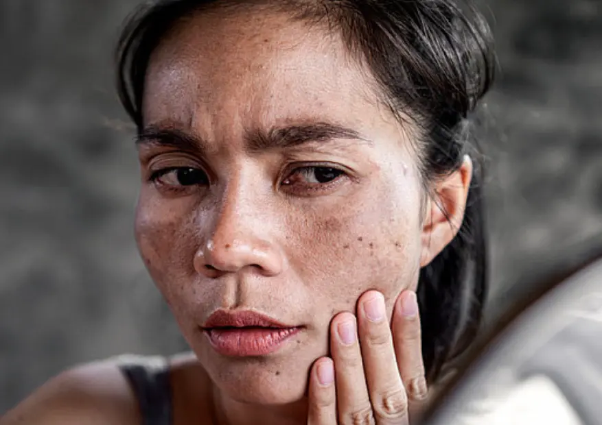 The Hidden Risks of Waxing on Irritated or Sun-Damaged Skin